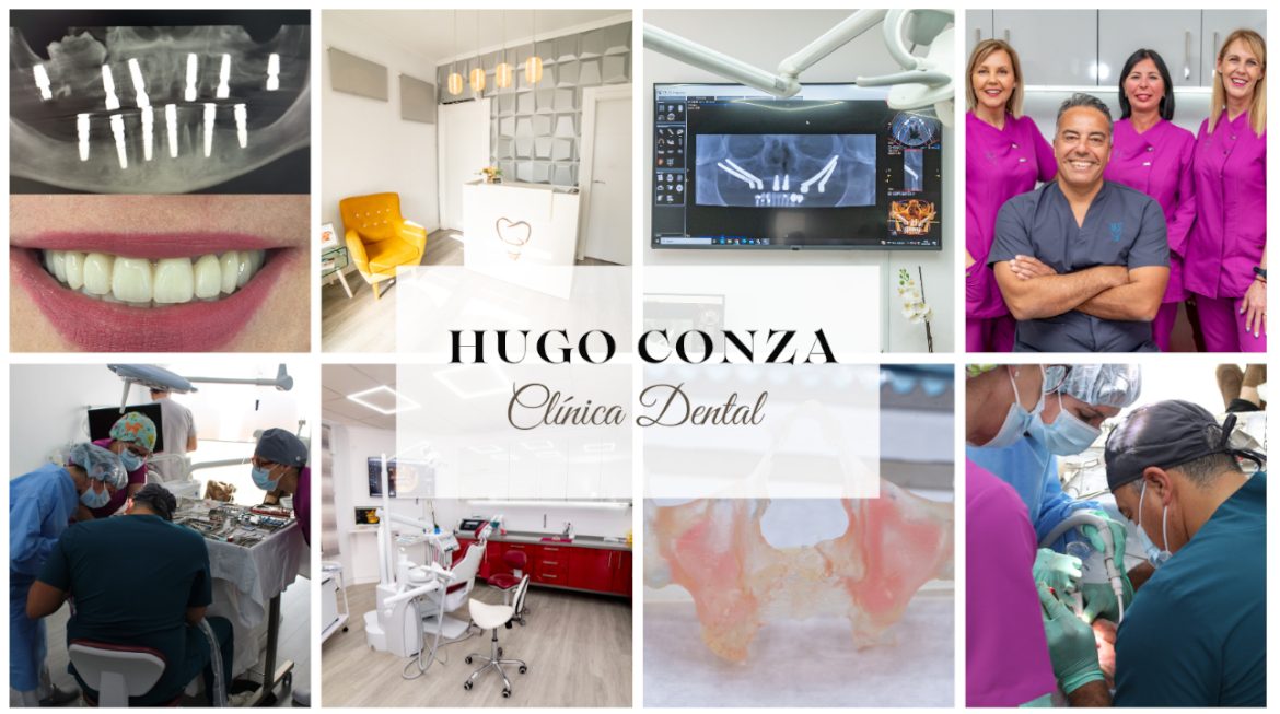 Estrenamos Web y Blog en Clínica Dental Hugo Conza