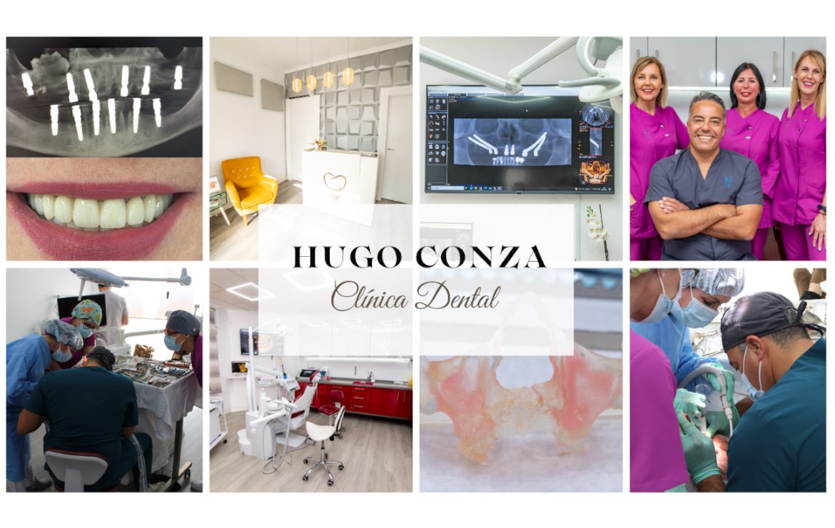 Estrenamos Web y Blog en Clínica Dental Hugo Conza