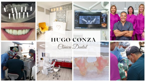Estrenamos Web y Blog en Clínica Dental Hugo Conza