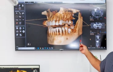 Diagnóstico 3D