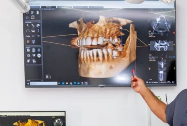 Diagnóstico 3D