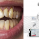 Manchas en los Dientes: Causas y Soluciones