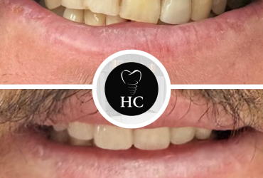 Post de Instagram Collage de Fotos Verano Pastel