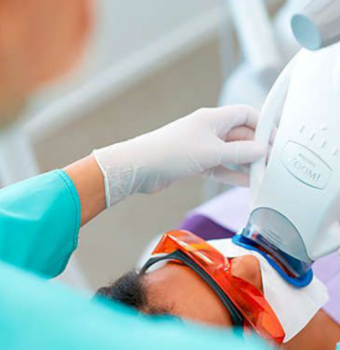 Luce dientes más blancos con nuestros blanqueamientos profesionales