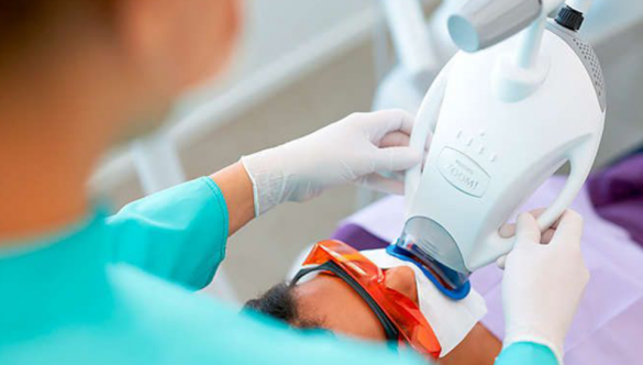 Luce dientes más blancos con nuestros blanqueamientos profesionales