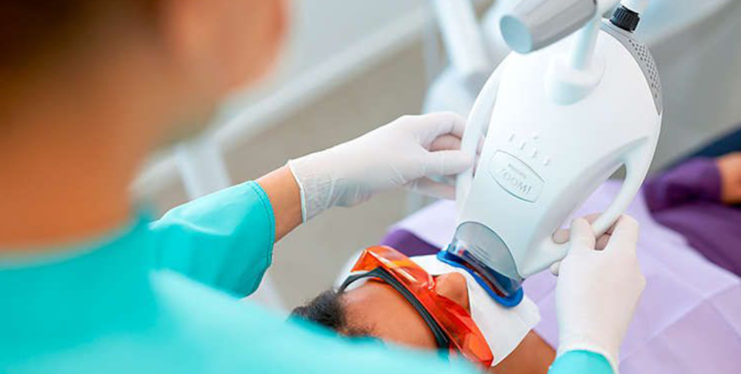 Luce dientes más blancos con nuestros blanqueamientos profesionales