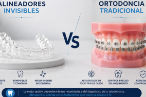 ¿Cuánto dura un tratamiento de ortodoncia?  Brackets vs alineadores invisibles