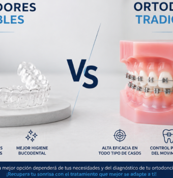 ¿Cuánto dura un tratamiento de ortodoncia?  Brackets vs alineadores invisibles