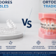¿Cuánto dura un tratamiento de ortodoncia?  Brackets vs alineadores invisibles