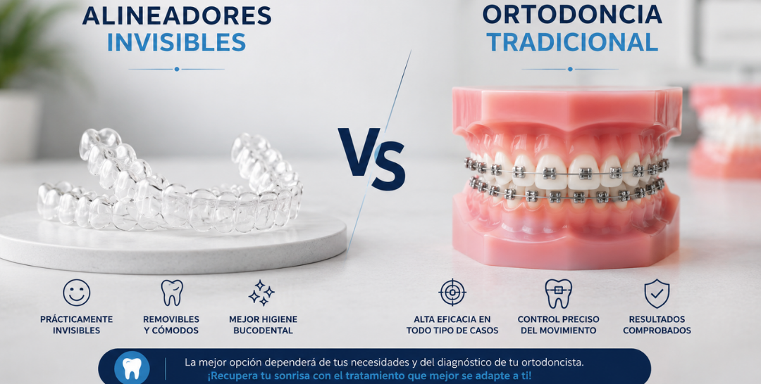 ¿Cuánto dura un tratamiento de ortodoncia?  Brackets vs alineadores invisibles